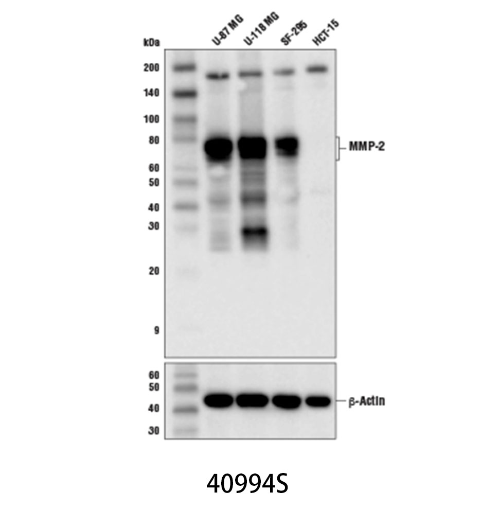 MMP-2 (D4M2N) Rabbit mAb