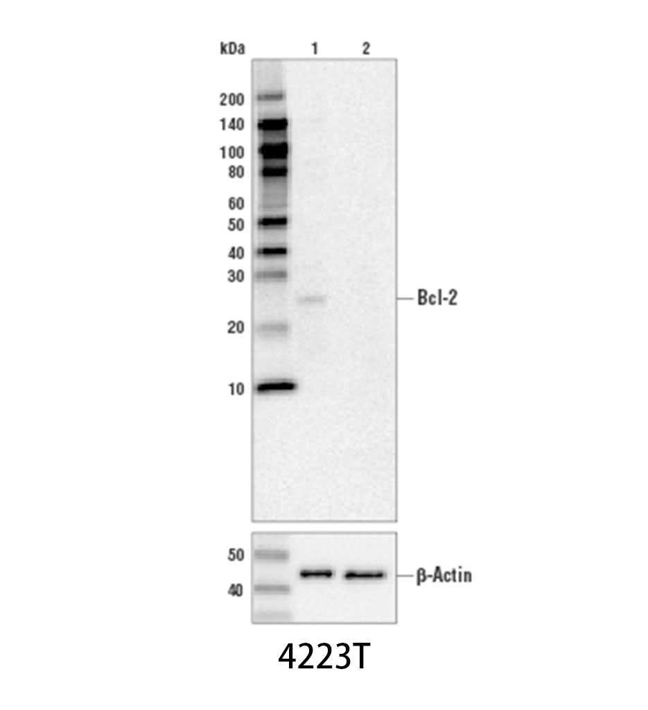Bcl-2 (D55G8) Rabbit mAb (Human Specific)