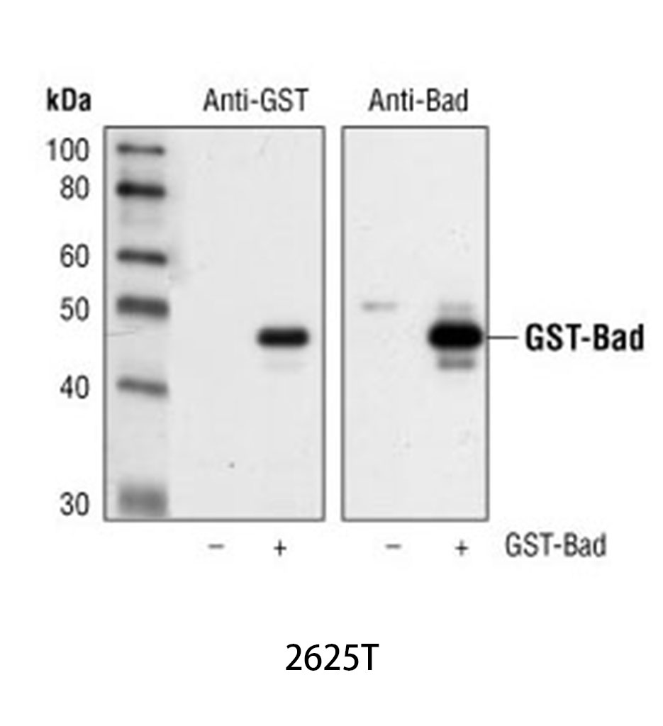 GST (91G1) Rabbit mAb