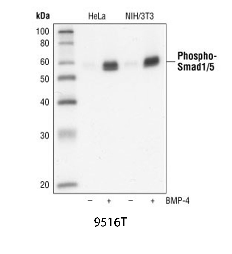 Phospho-Smad1/5 (Ser463/465) (41D10) Rabbit mAb