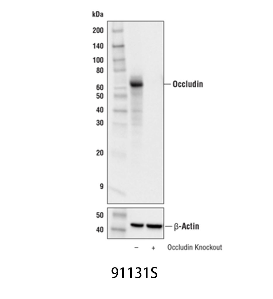 Occludin (E6B4R) Rabbit mAb