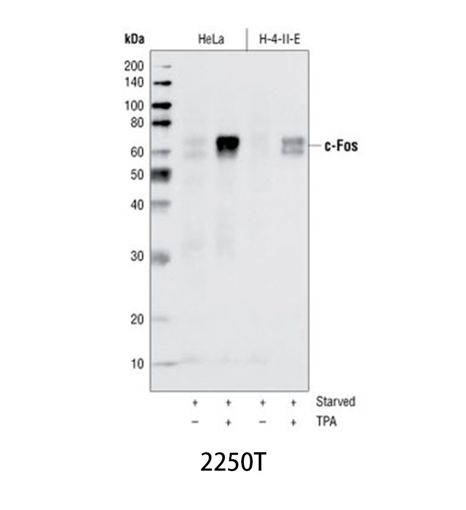 c-Fos (9F6) Rabbit mAb