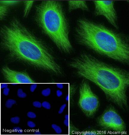 Goat Anti-Rabbit IgG H&amp;L (Alexa Fluor488) 荧光二抗