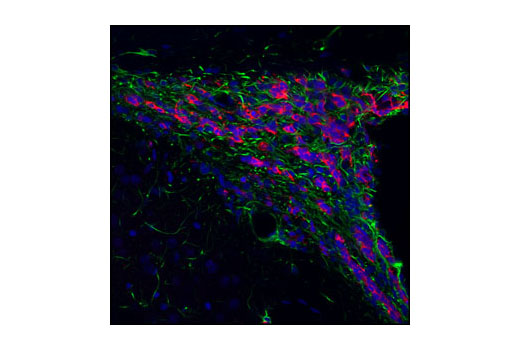 Doublecortin Antibody