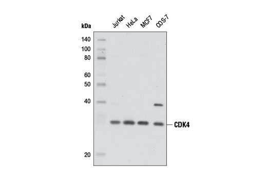 CDK4 (D9G3E) Rabbit mAb