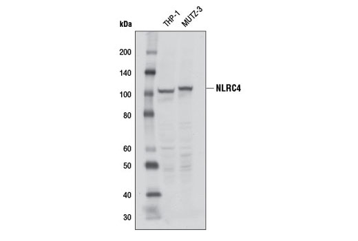 Human Reactive Inflammasome Antibody Sampler Kit II