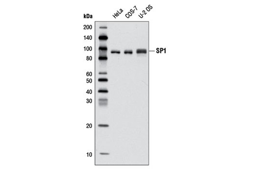 SP1 (D4C3) Rabbit mAb