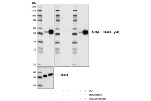 Acetyl-α-Tubulin (Lys40) (D20G3) XP Rabbit mAb