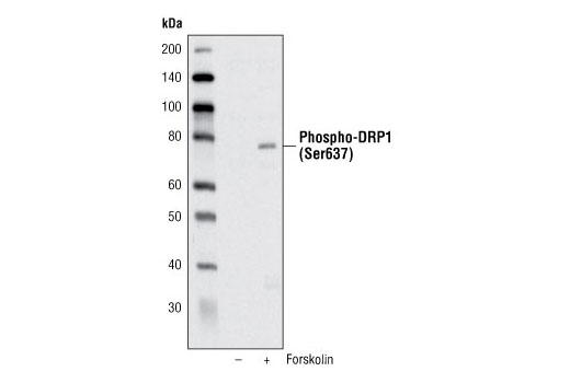 Phospho-DRP1 (Ser637) Antibody