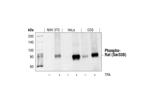 Phospho-c-Raf (Ser338) (56A6) Rabbit mAb
