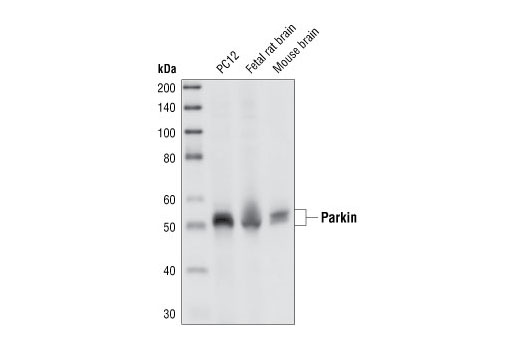 Parkin (Prk8) Mouse mAb