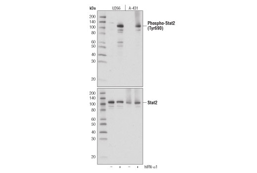 Phospho-Stat2 (Tyr690) (D3P2P) Rabbit mAb