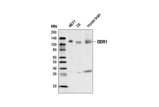 DDR1 (D1G6) XP Rabbit mAb