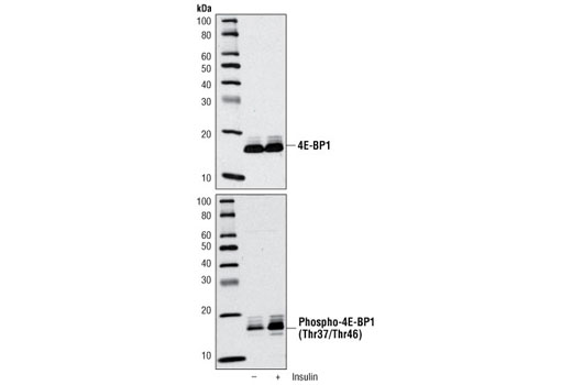 Phospho-4E-BP1 (Thr37/46) Antibody