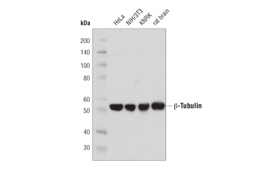 β-Tubulin (D3U1W) Mouse mAb