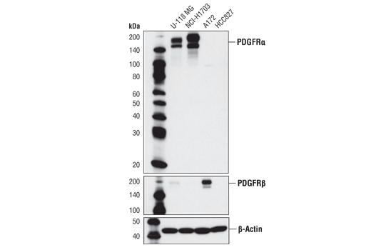 PDGF Receptor α (D13C6) XP Rabbit mAb