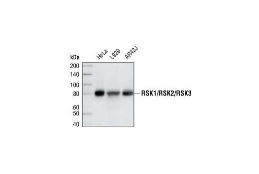 RSK1/RSK2/RSK3 (32D7) Rabbit mAb