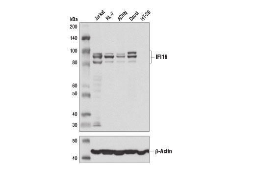 IFI16 (D8B5T) Rabbit mAb