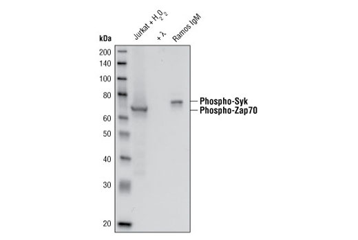 Phospho-Zap-70 (Tyr319)/Syk (Tyr352) (65E4) Rabbit mAb