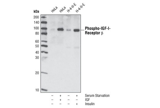 Phospho-IGF-I Receptor β (Tyr1135/1136)/Insulin Receptor β (Tyr1150/1151) (19H7) Rabbit mAb