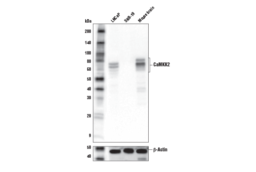 CaMKK2 (D8D4D) Rabbit mAb