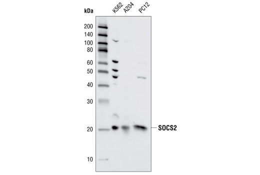 Jak/Stat Pathway Inhibitors Antibody Sampler Kit