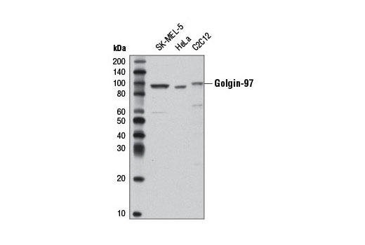 Golgin-97 (D8P2K) Rabbit mAb
