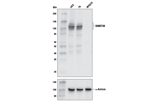 DNMT3B (E4I4O) Rabbit mAb (Mouse Specific)