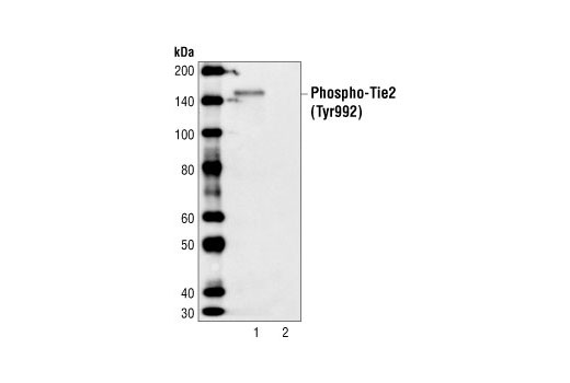 Phospho-Tie2 (Tyr992) Antibody