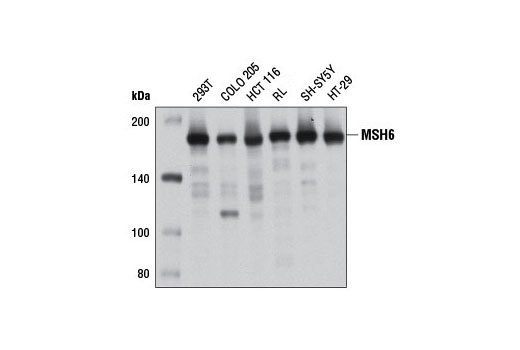 MSH6 (3E1) Mouse mAb