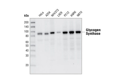 Glycogen Synthase (15B1) Rabbit mAb