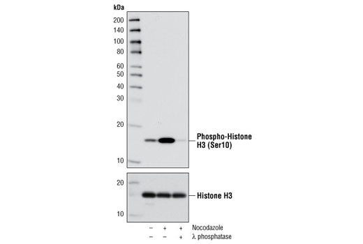 Phospho-Histone H3 (Ser10) (D2C8) XP Rabbit mAb