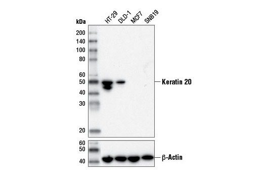 Keratin 20 (D9Z1Z) XP Rabbit mAb