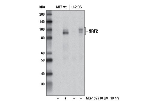 Sequestosome Signaling Antibody Sampler Kit