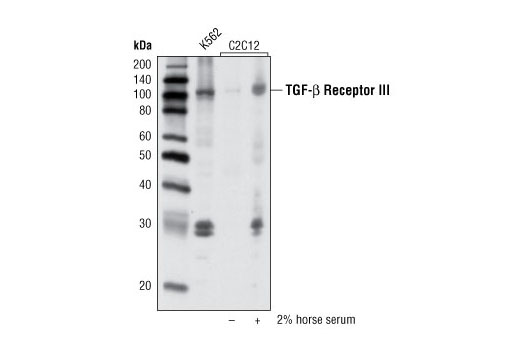 TGF-beta Receptor III (D11G10) Rabbit mAb
