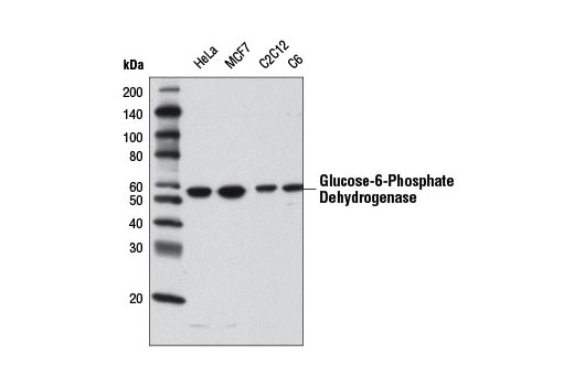 Glucose-6-Phosphate Dehydrogenase Antibody