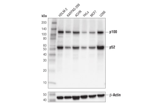 NF-κB2 p100/p52 (D7A9K) Rabbit mAb