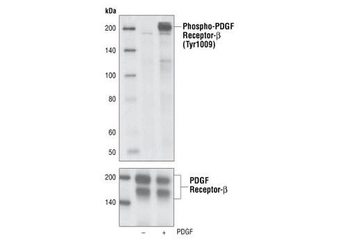 Phospho-PDGF Receptor β (Tyr1009) (42F9) Rabbit mAb