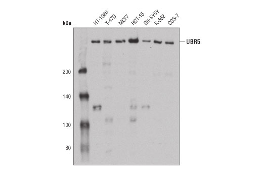 UBR5 (D6O8Z) Rabbit mAb