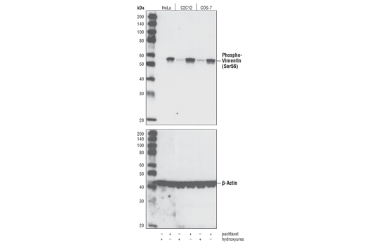 Phospho-Vimentin (Ser56) Antibody