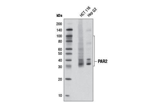 PAR2 (D61D5) Rabbit mAb