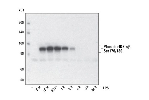 Phospho-IKKα/β (Ser176/180) (16A6) Rabbit mAb