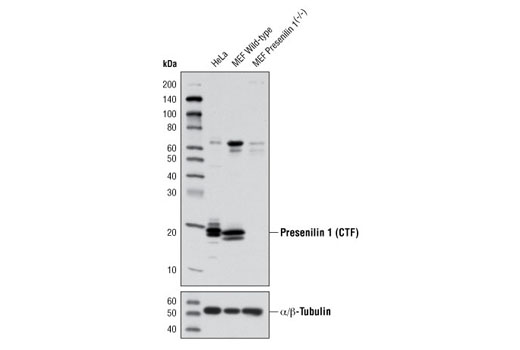 Presenilin 1 (D39D1) Rabbit mAb