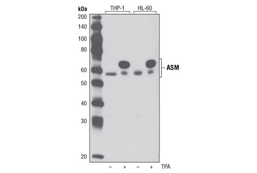 ASM Antibody