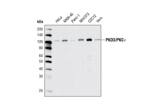 PKD3/PKCν (D57E6) Rabbit mAb