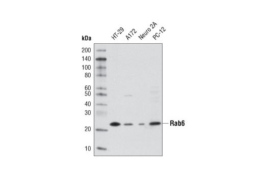 Rab6 (D37C7) Rabbit mAb