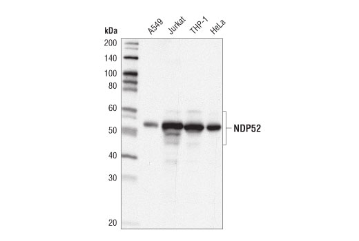 NDP52 (D1E4A) Rabbit mAb