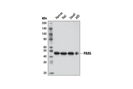 PAX5 (D19F8) XP Rabbit mAb