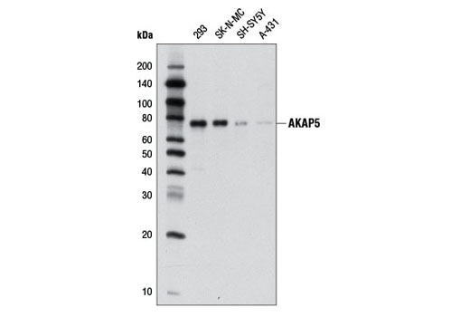 AKAP5 (D28G3) Rabbit mAb