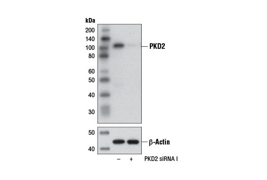 SignalSilence PKD2 siRNA I